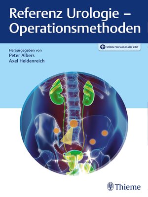 cover image of Referenz Urologie--Operationsmethoden